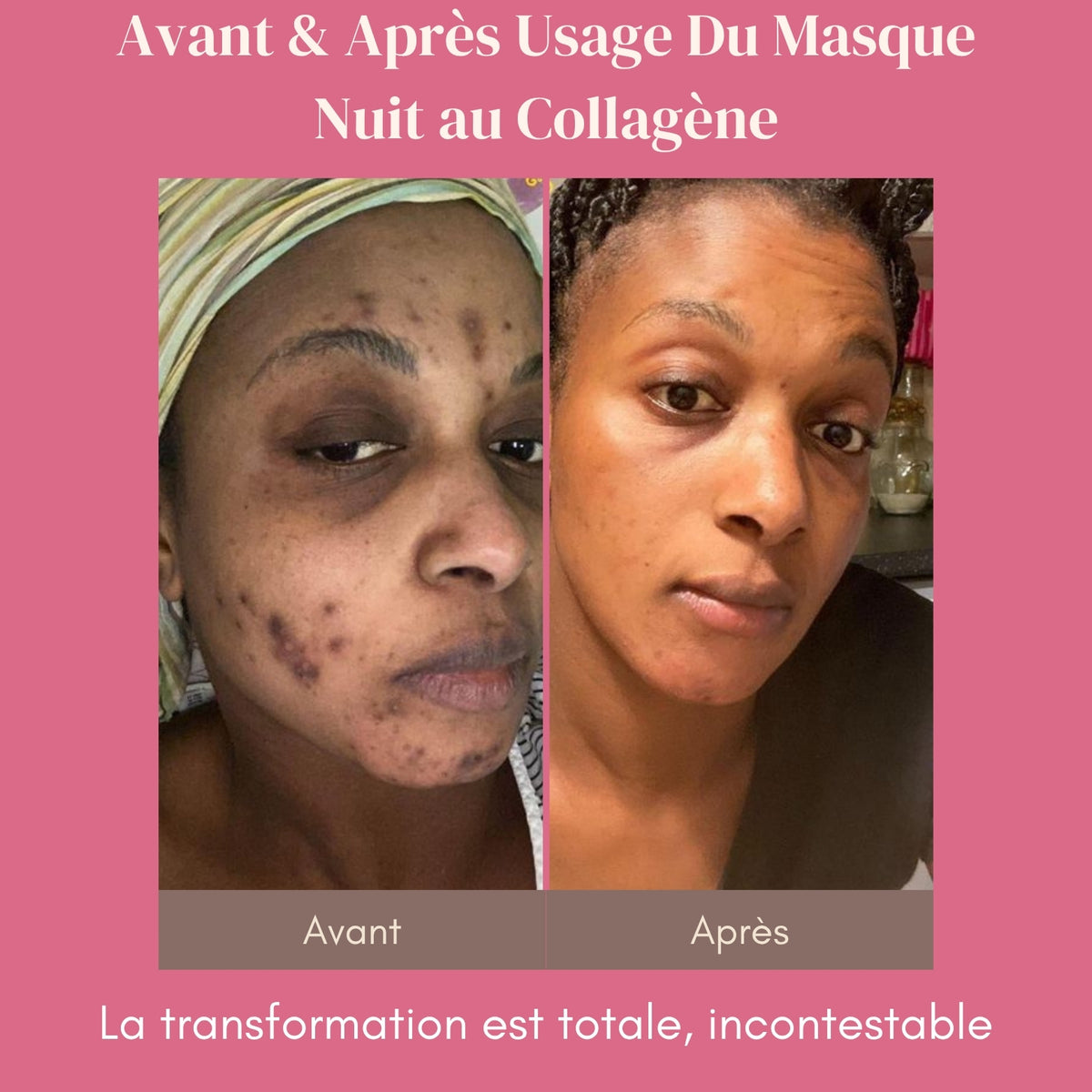 Masque de Nuit au Collagène - La Peau de Vos Rêves, au Réveil