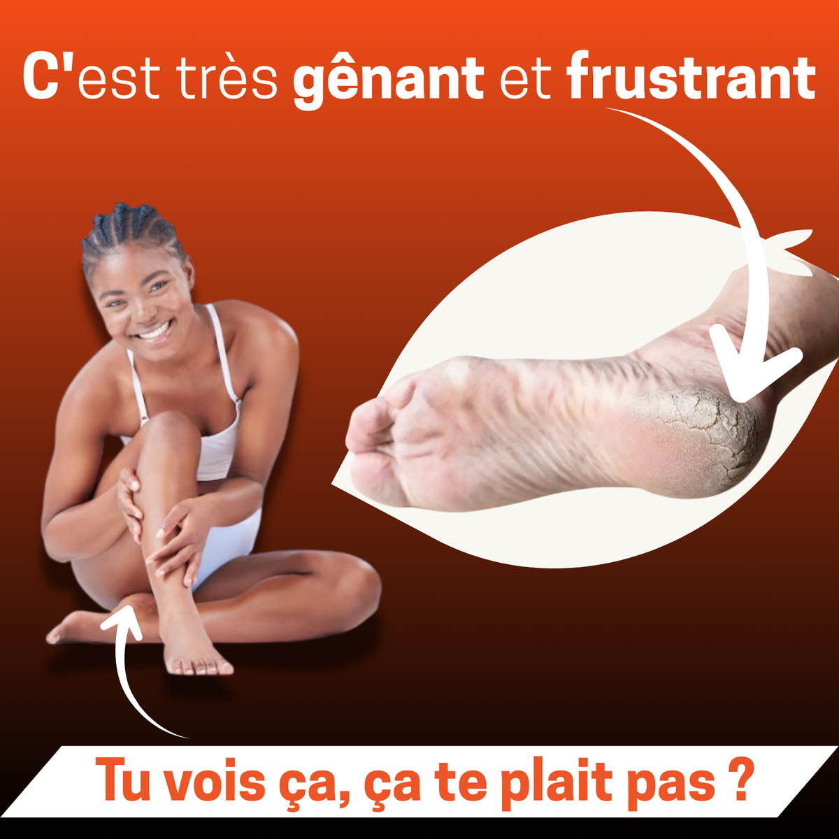 👣 KIT ÉLECTRIQUE ANTI-CALLOSITÉS – Ta Confiance Commence par Tes Pieds !