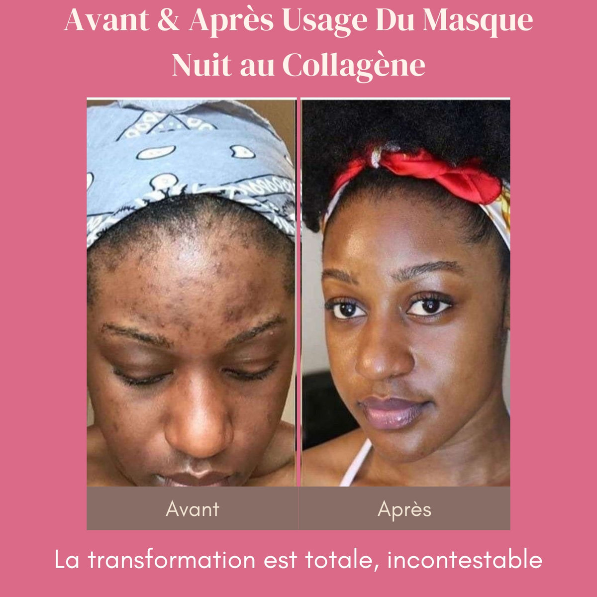 Masque de Nuit au Collagène - La Peau de Vos Rêves, au Réveil