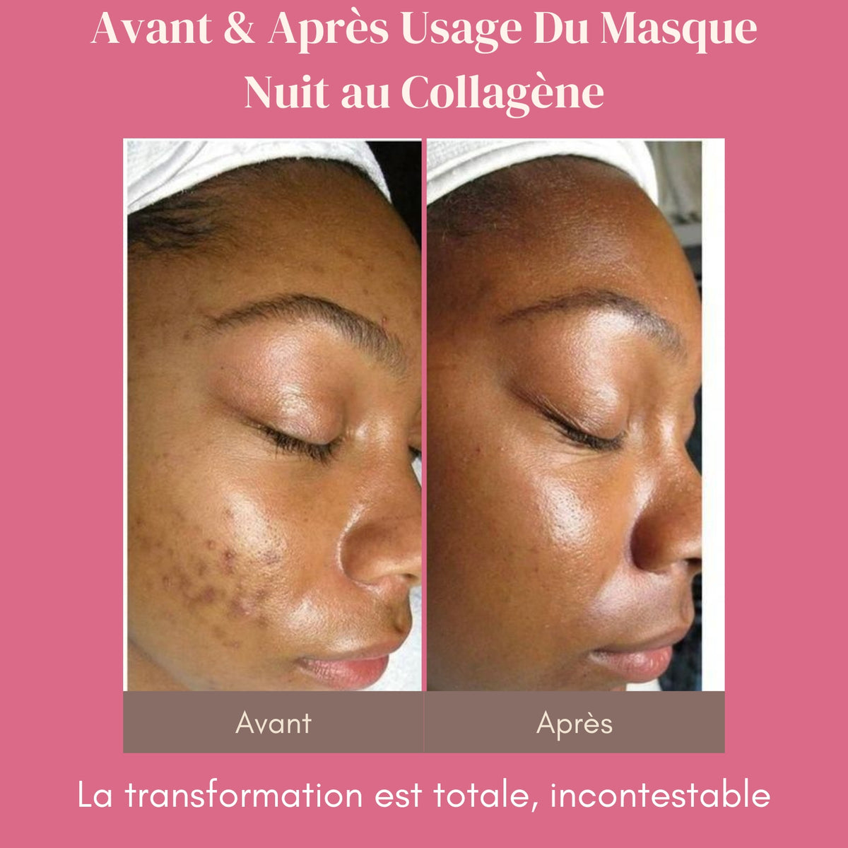 Masque de Nuit au Collagène - La Peau de Vos Rêves, au Réveil