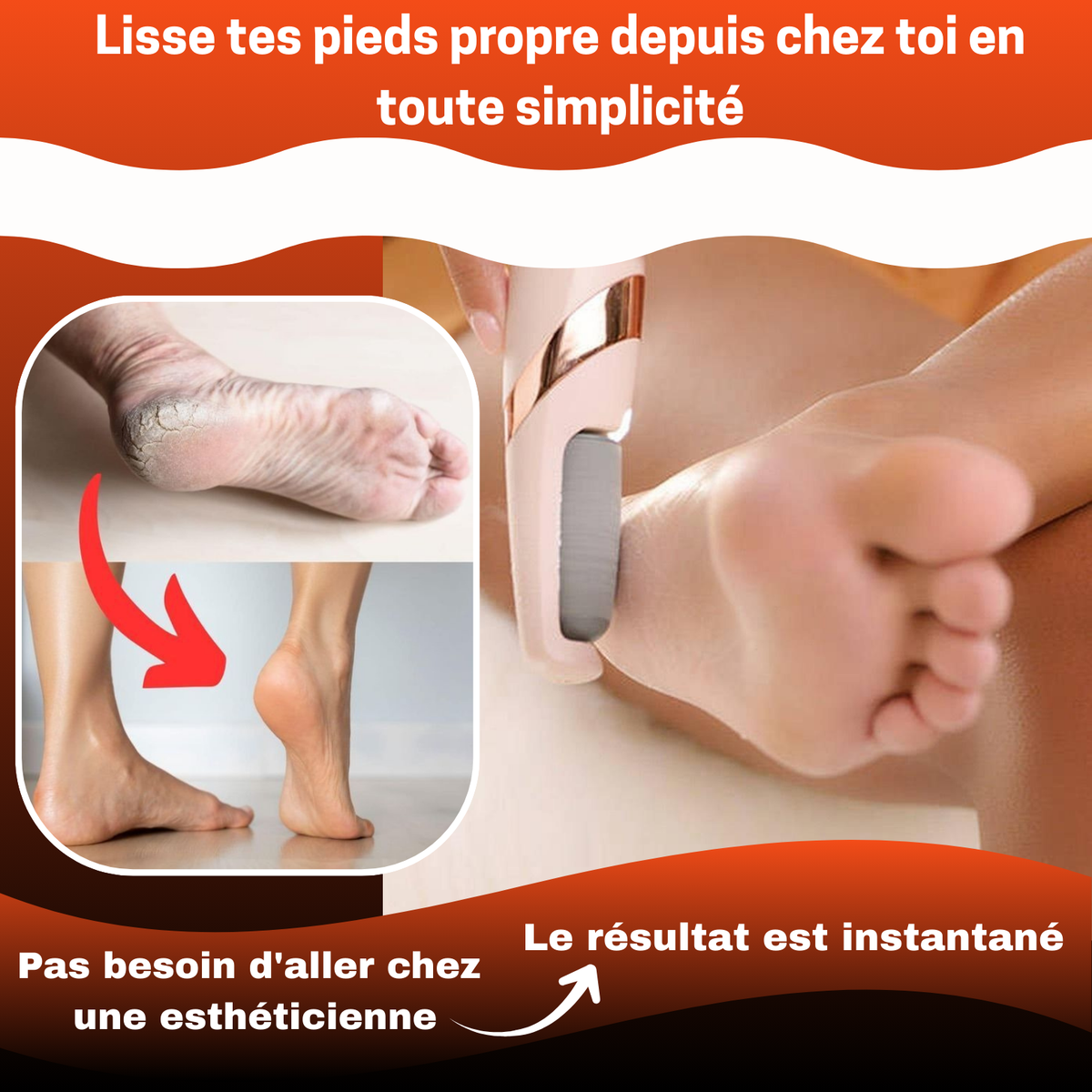 👣 KIT ÉLECTRIQUE ANTI-CALLOSITÉS – Ta Confiance Commence par Tes Pieds !