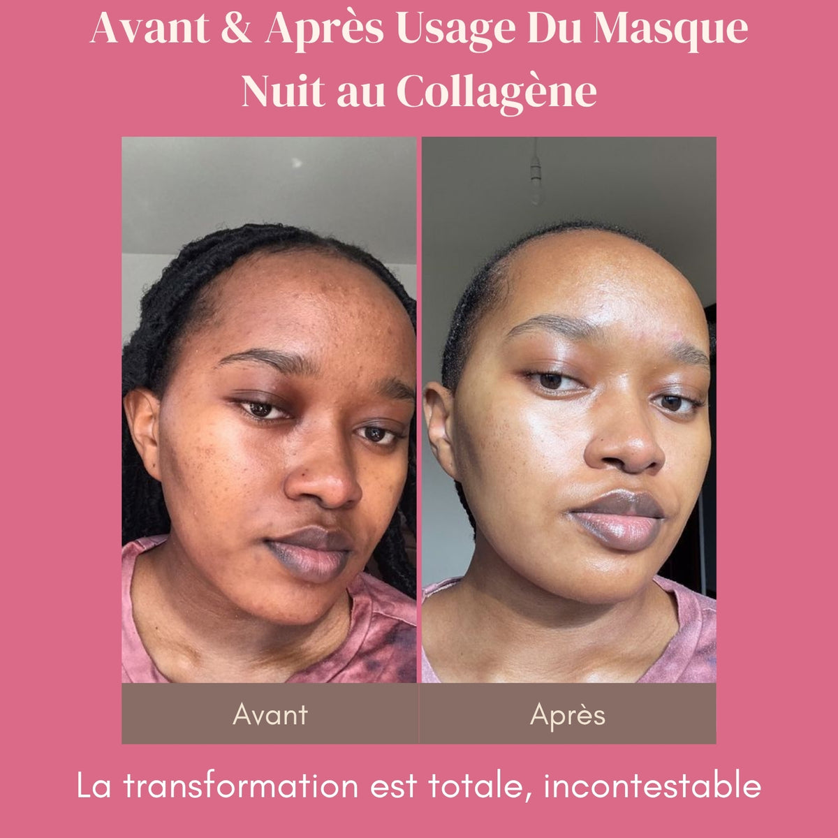 Masque de Nuit au Collagène - La Peau de Vos Rêves, au Réveil