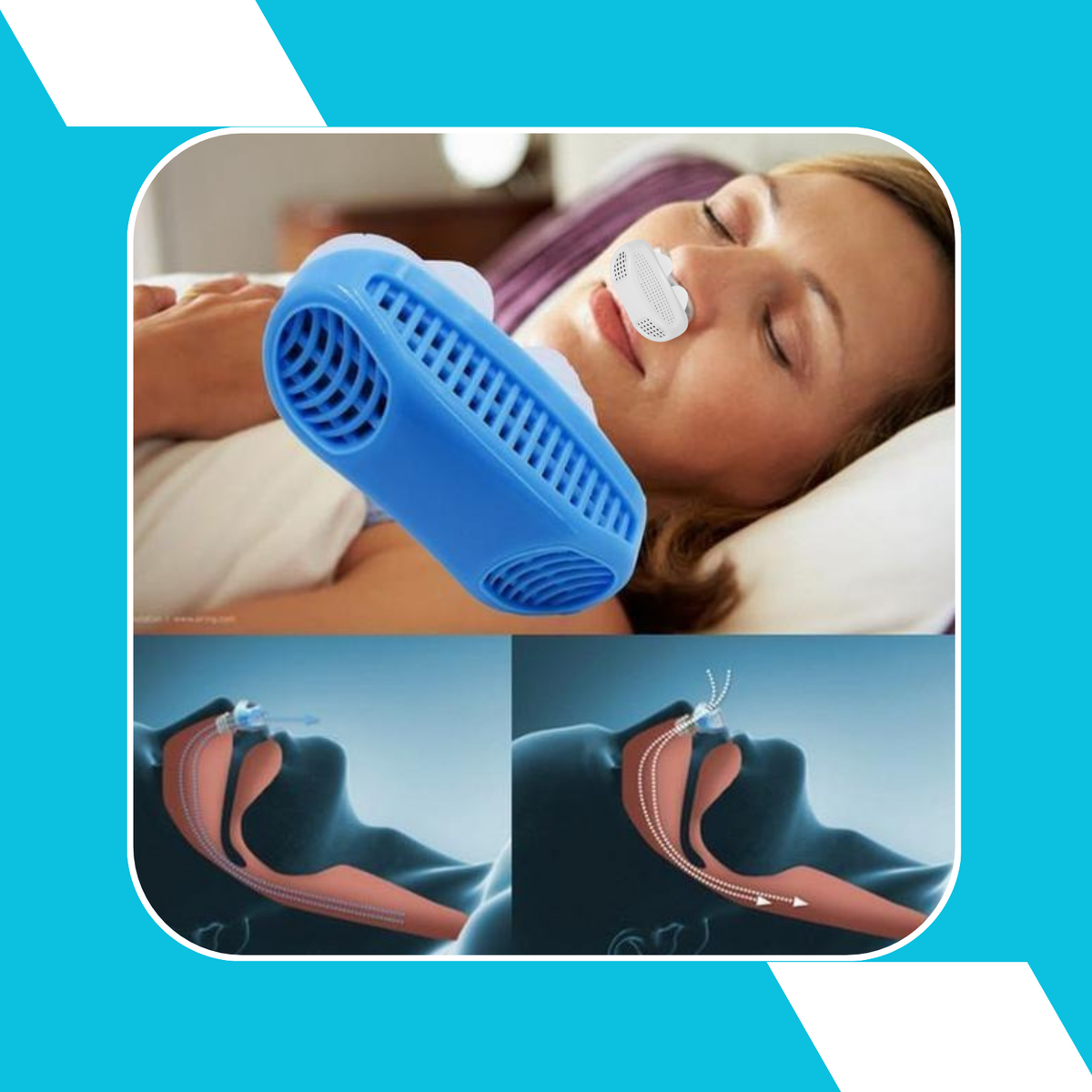 Solution Anti-Ronflement Nuit-Paisible