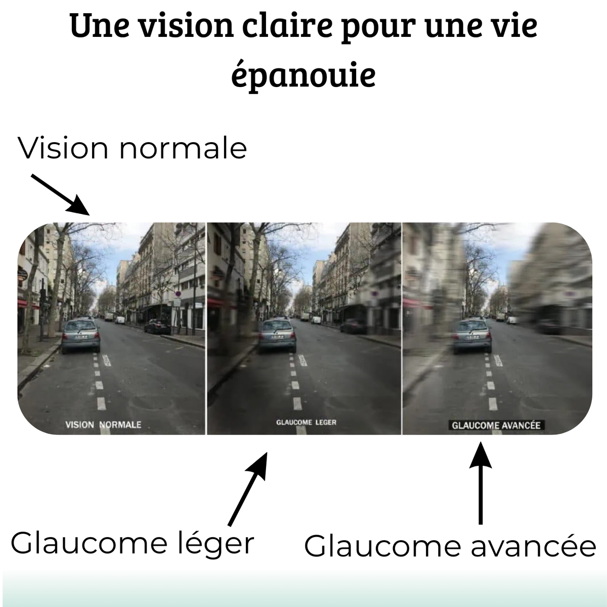 VISION ENHANCE ROLLER : La clarté - Offrez à Vos Yeux une Vitalité Nouvelle