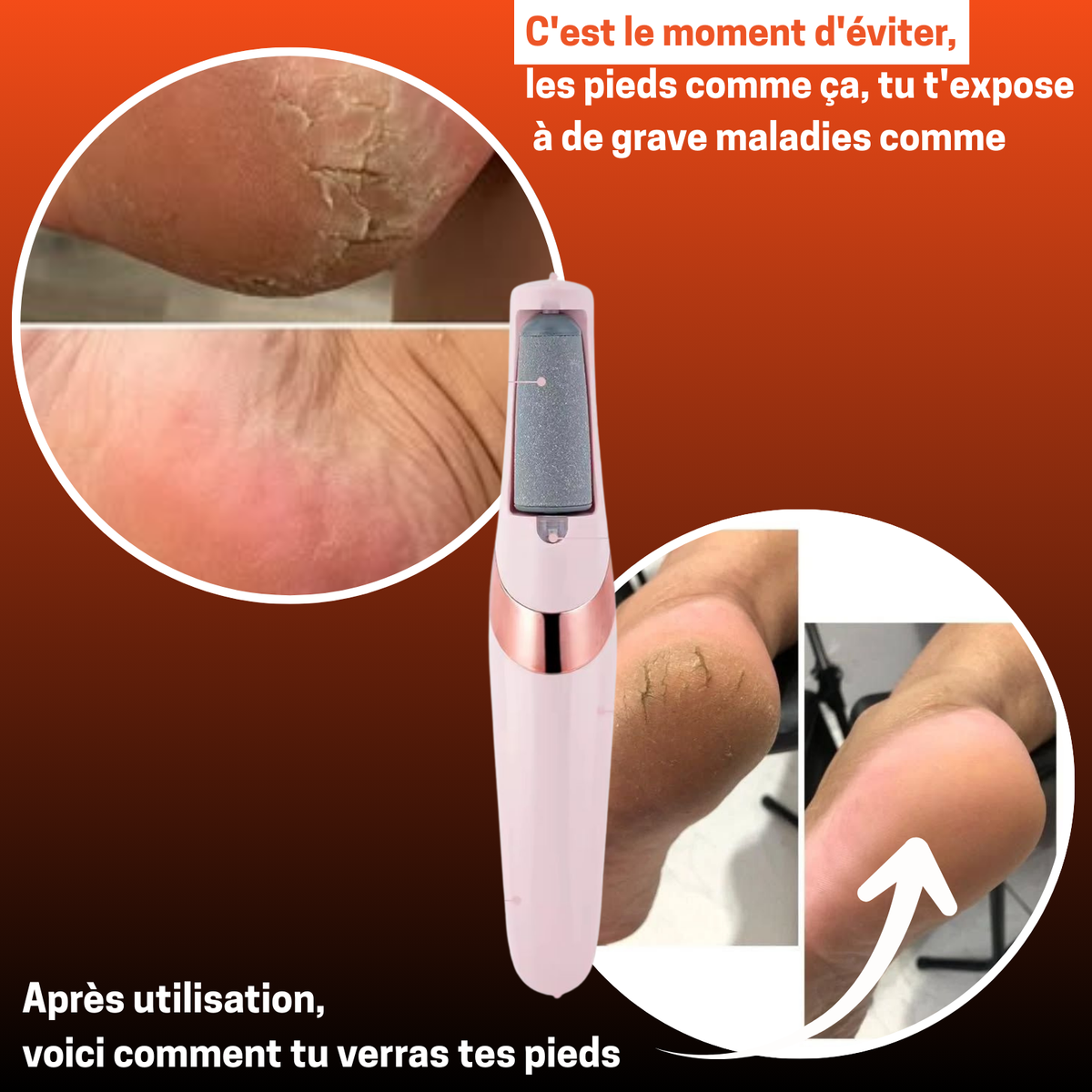 👣 KIT ÉLECTRIQUE ANTI-CALLOSITÉS – Ta Confiance Commence par Tes Pieds !