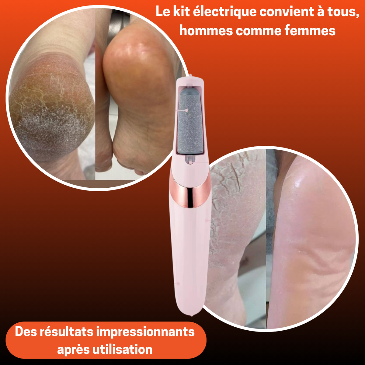 👣 KIT ÉLECTRIQUE ANTI-CALLOSITÉS – Ta Confiance Commence par Tes Pieds !