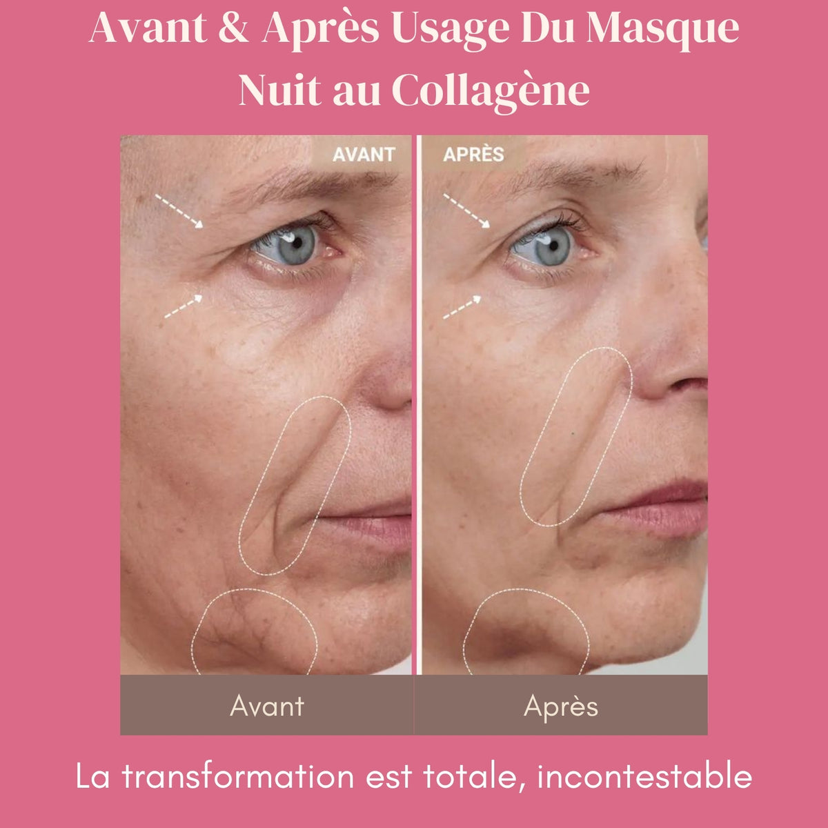 Masque de Nuit au Collagène - La Peau de Vos Rêves, au Réveil