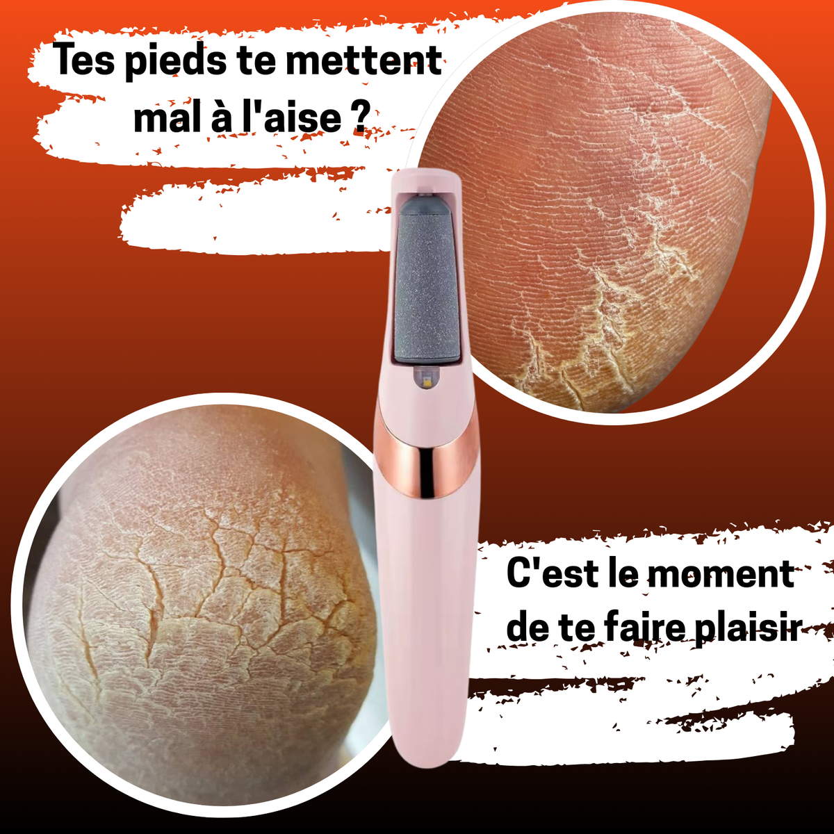 👣 KIT ÉLECTRIQUE ANTI-CALLOSITÉS – Ta Confiance Commence par Tes Pieds !