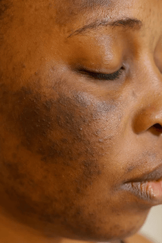 GEL EXFOLIANT À L’ORANGE –  Le secret pour une peau éclatante et sans imperfections